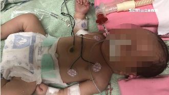 男嬰搶救5個月過世　夫妻怒控醫疏失