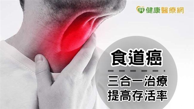 熟男殺手食道癌 　三合一才拼得贏