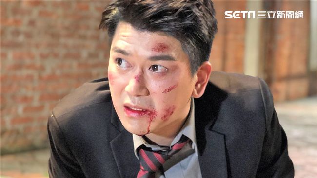 「蛋蛋」的哀傷…男星重要部位遭重擊