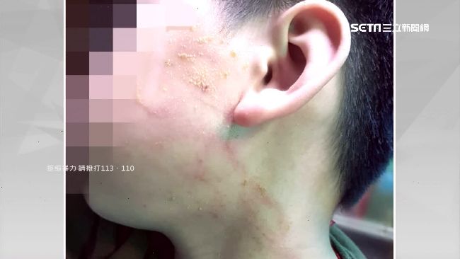 男童上補習班被賞巴掌　主任：想嚇他