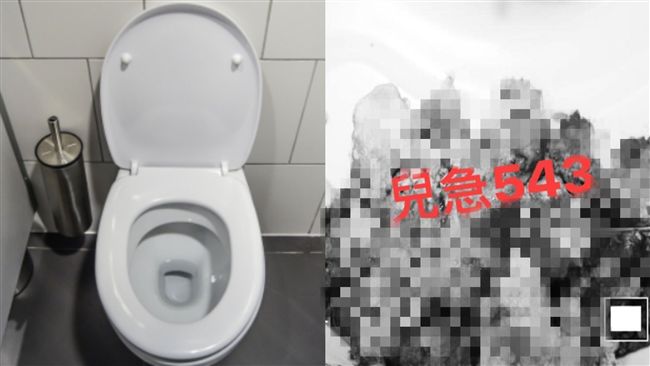 女童狂吐3天肚脹！醫手術挖一大盆屎