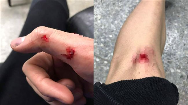 不滿計程車喊價！男拒付帳遭運將打傷