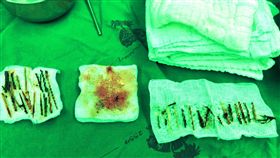 木條,泰國,鼻孔,呼吸,鼻腔,醫師
https://www.facebook.com/permalink.php?story_fbid=2230124413692555&id=555935097778170