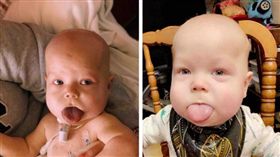 寶寶肚中狂吐舌「超可愛」…生下才知罕病讓媽秒崩潰（圖／翻攝自baker-strong GoFundMe）