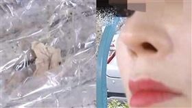 隆鼻,整容,棉球,整形,大陸,江西,打噴嚏,醫療疏失　圖／翻攝自微博
