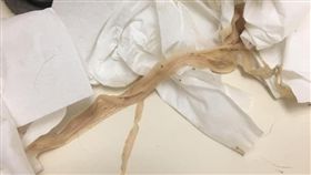 貓咪肛門卡絛蟲（圖／翻攝自貓咪也瘋狂俱樂部 CrazyCat club臉書）