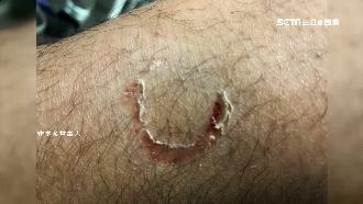 不滿攔查拒檢　男狠咬警竟獲判無罪！