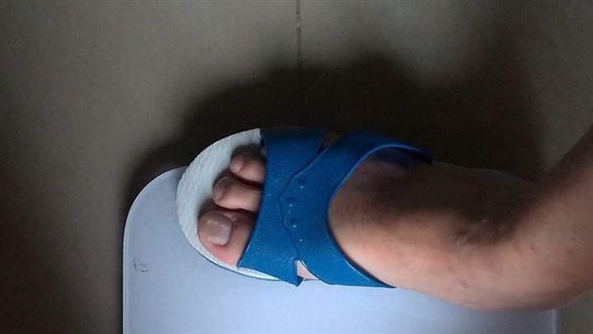 男滑倒求償百萬　因穿藍白拖賠償砍半