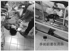 桃園,家暴,割腕,輕生,急診,鎮定劑,爆料公社