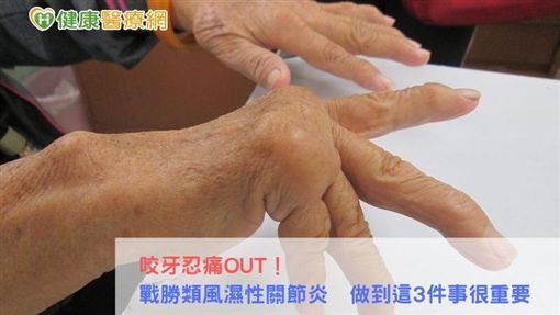 臨床觀察發現口服小分子藥在某些情況有較佳的改善關節腫脹效果,又可以免去打針的痛苦、攜帶方便,普遍較受年輕族群的青睞。