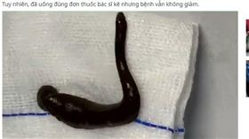 越男咳血一個月 氣管夾出15公分活水蛭（圖／翻攝自Vietnamnet）