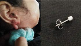 女童嗨玩到一半...耳環勾窗簾　耳垂直接被扯成「鮮血肉塊(圖/臉書)