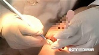 長庚看牙現異狀！桃醫「首病患染疫」