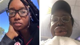 睡前嗑漢堡　她睡醒變「充氣娃娃嘴」（圖／翻攝自推特https://twitter.com/deelishhhh_）