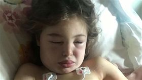 7歲女童被大黃蜂群起攻擊狂螫300下，臉腫到面目全非。（圖／翻攝ABC News）