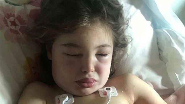 大黃蜂群狂螫3百下　7歲女面目全非