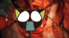 腦瘤,牙齒,手術,醫療,科技,顱咽管瘤,美國, 圖／翻攝自推特 