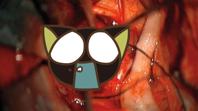 前所未見！四月大男嬰腦長…嚇壞醫師