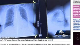 美國,狗狗,驅蟲藥,癌症,癌細胞,痊癒
https://www.dailymail.co.uk/health/article-6965325/Oklahoma-grandfather-claims-drug-DOGS-cured-cancer-tumor-free.html