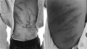 中國,揚州,家暴,女童（圖／翻攝自澎湃新聞）