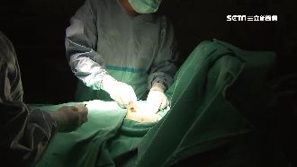 微創手術治療降低存活率？台醫師駁斥