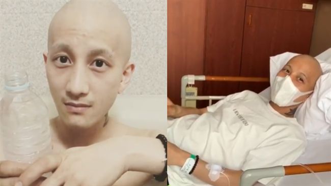 女星夫罹睪丸癌　副作用腳像黏垃圾…