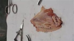 雞翅練習割雙眼皮，兩天速成美容師？辯稱「總不能用真人吧」。（圖／翻攝自雲上襄陽）