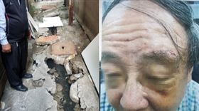 板橋仁愛國宅路爛導致教授摔成豬頭，葉元之辦公室提供，水溝破損及教授受傷，組合圖