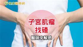 子宮肌瘤發生與飲食、生活作息沒有直接關係，與女性荷爾蒙則相對有關，呼籲女性朋友應定期婦科檢查。