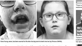 英國,狗狗,飼主,自閉症,女童,咬爛,嘴唇
https://metro.co.uk/2019/05/02/dog-ripped-off-girls-lip-when-she-went-to-pet-it-in-pub-car-park-9386888/