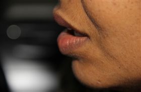 「3不」7旬婦罹口腔癌 導因竟是假牙不合嘴（圖／ＰＩＸＡＢＡＹ）