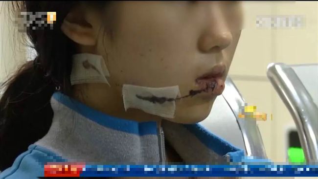 男追15歲少女遭拒　持刀狂割毀她臉