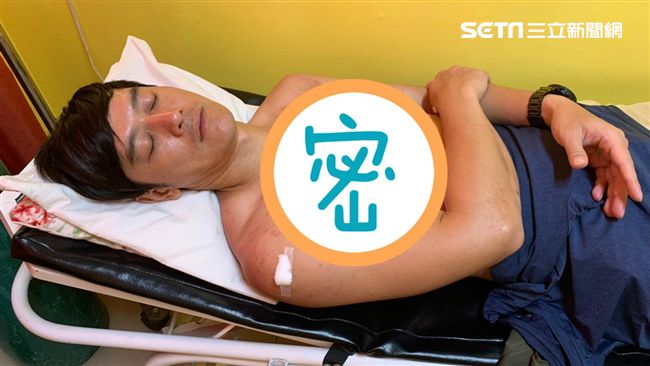男星外景罹病毒疹！傷口破皮險釀重病