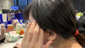 頭痛，偏頭痛，青春痘，頭暈，示意圖，不用寫記者名，寫資料照