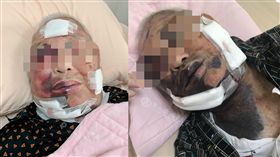 竹筍湯,家暴,肋骨,孽子,新竹