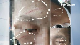 保全被打躲超商　店員阻擋遭掐脖抓傷