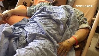 偷襲式撞2機車逃逸　騎士重傷躺病床