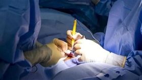 （圖／翻攝自微博）手術,男性結紮