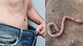 大學生,陰囊,蚯蚓,精索靜脈曲張,下體（組合圖／PIXABAY）