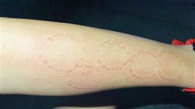 不少熱戀中的情侶，會互相在對方身體「種草莓」來宣示主權。但大陸一名男子抱怨，他的網戀女友不是在他身上「種草莓」，而是瘋狂留下「咬痕」，導致他的手臂上出現「奧運五環」的紋路，讓他嚇得不敢與女友約會。（圖／翻攝自微博）