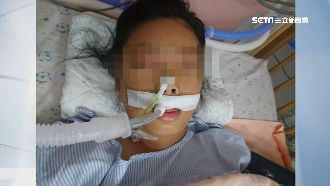 野狗追逐摔車！女童昏迷68天走了