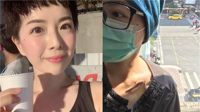 驚罹卵巢癌！她淚摘子宮竟還被小三嗆