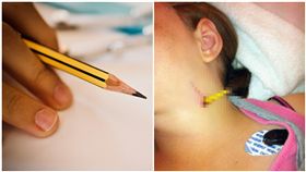 超過「半支筆」沒入她身！11歲女童跌倒，鉛筆竟插進她頸動脈。（圖／翻攝自英國醫學期刊、pixabay）