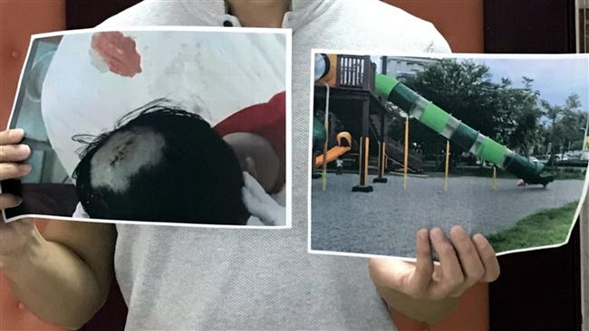 頭皮被溜滑梯割傷　男童傷口血流如注