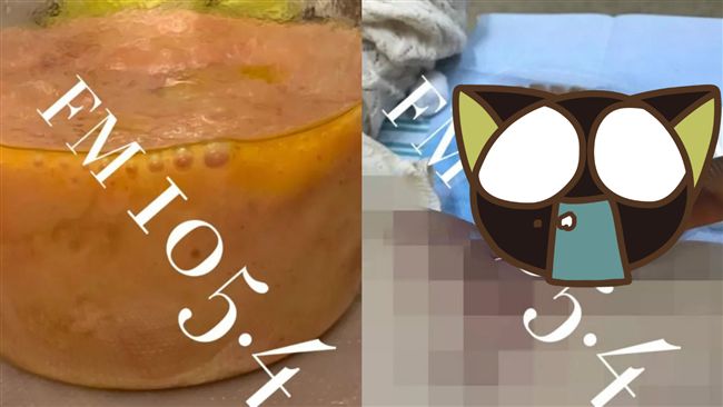 女花百萬隆乳！結果化膿爛掉打回原形