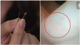 台中幼兒園學童疑遭教師別針戳手(圖/資料照、翻攝自臉書)