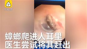 蟑螂,耳朵,灌水,小棍子,小蟲子(翻攝自梨視頻)
https://www.pearvideo.com/video_1557526
