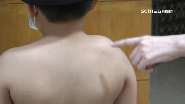 兒子調皮挨揍　媽控師：不是第一次了