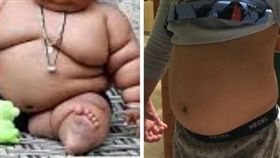 胖小孩, 兒童肥胖