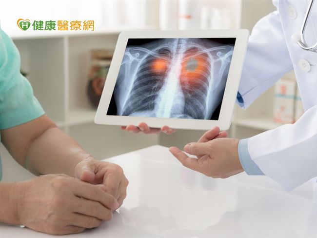 肺癌治療如同慢性病？這藥選擇是關鍵